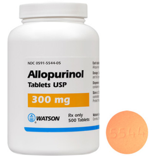 Alopurinol